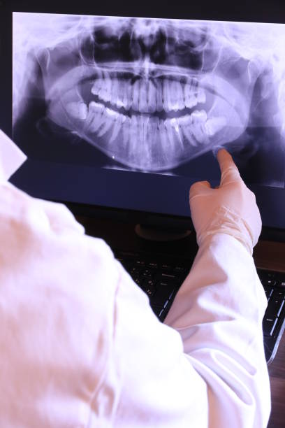 Best Emergency Root Canal Therapy in Lake Wildwood, CA