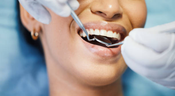 Best Walk-In Emergency Dental Services in Lake Wildwood, CA