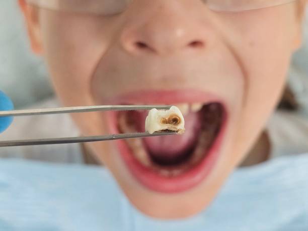 Best Emergency Pediatric Dental Care in Lake Wildwood, CA