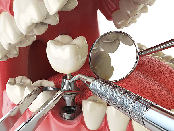 Best Emergency Treatment for Jaw Pain or Injury in Lake Wildwood, CA